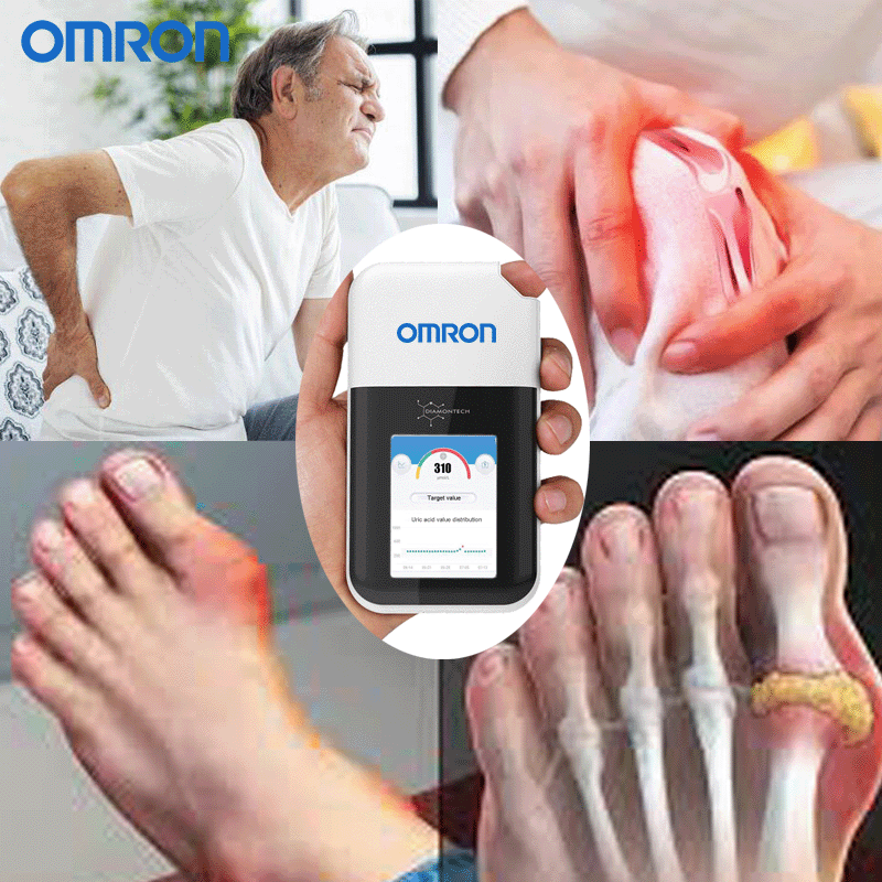 1726198001139965.gif A húgysavas fájdalom diagram másolata.gif