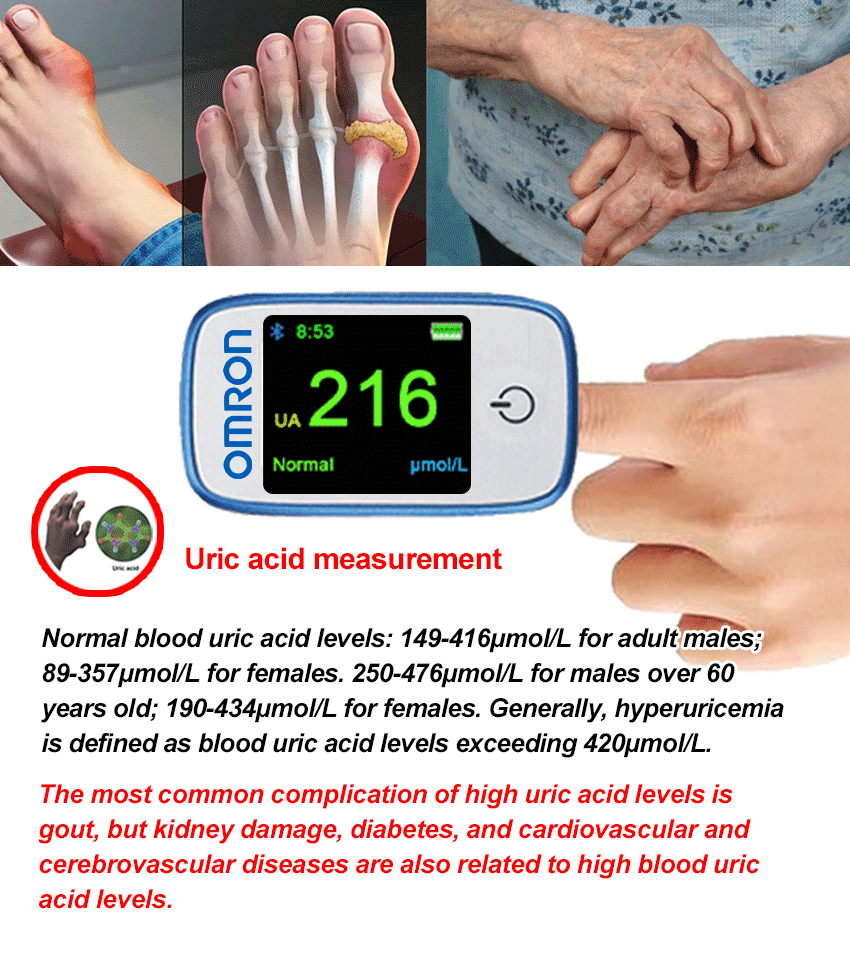 尿酸测量.gif