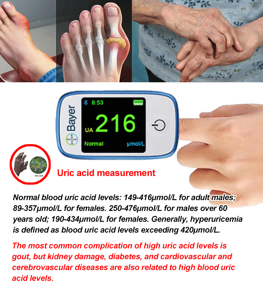 1737019053268684.gif 尿酸测量.gif