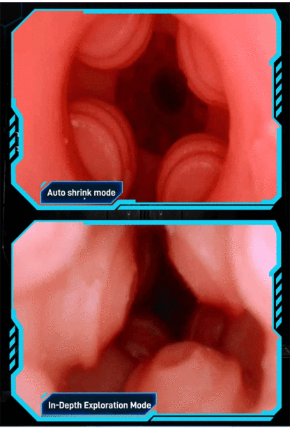 Fully automatic retractable decompression cup, no need to hold it by hand