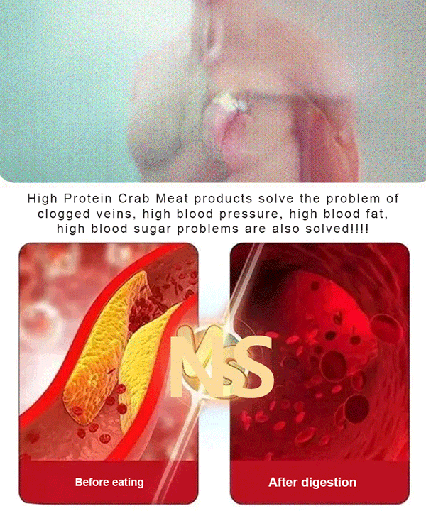 🦞【Hokkaido Selection】King Crab Whole Leg Meat