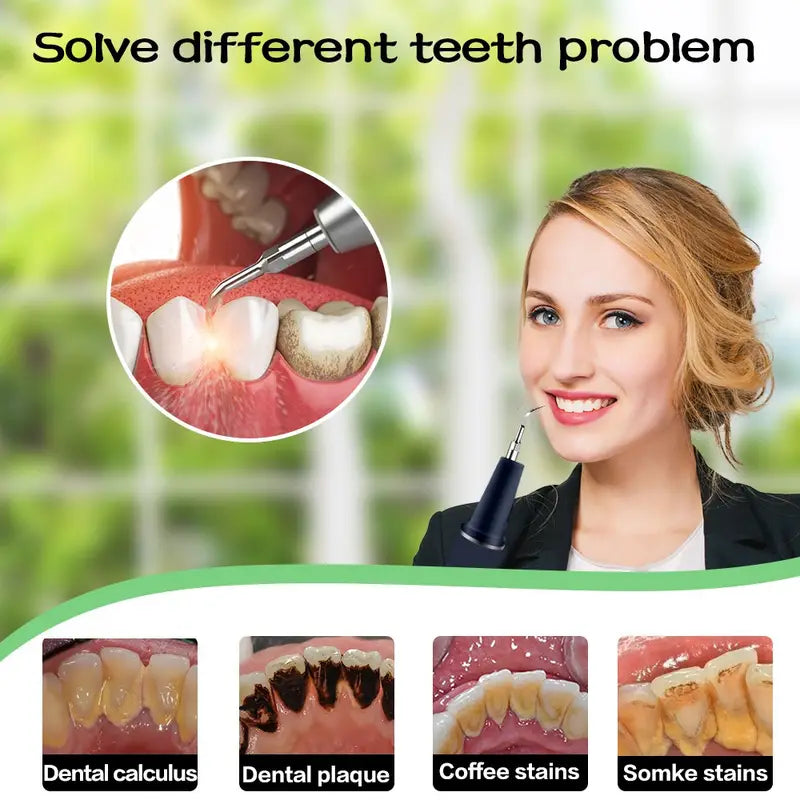 Dental Calculus Remover Teeth Cleaning Kit With LED Light-NBGRLVS