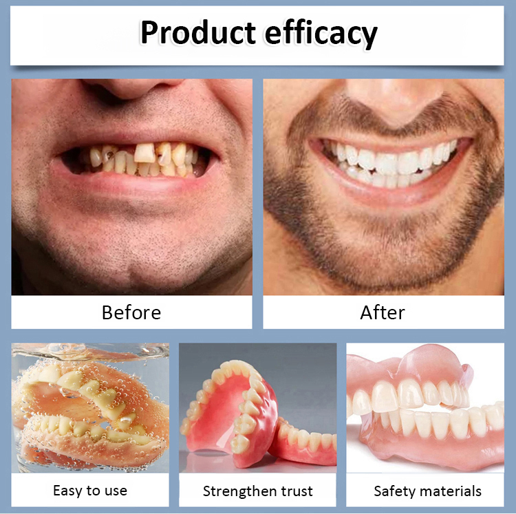 【All-Inclusive Customisation Package】Denture Care and Enhancement Kit