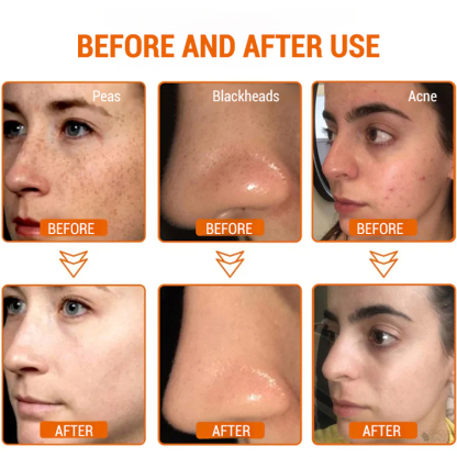 Whitening peel-off mask for sensitive skin