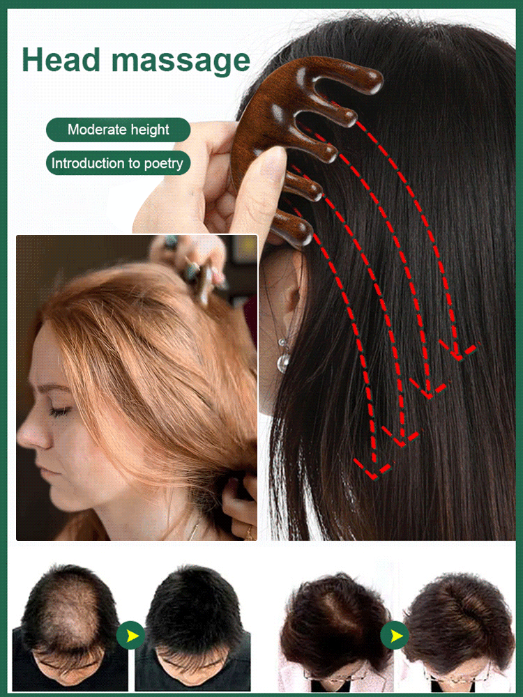 Gold wire five-tooth large ball massage comb