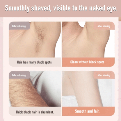 Dual-Head Hair Removal Device