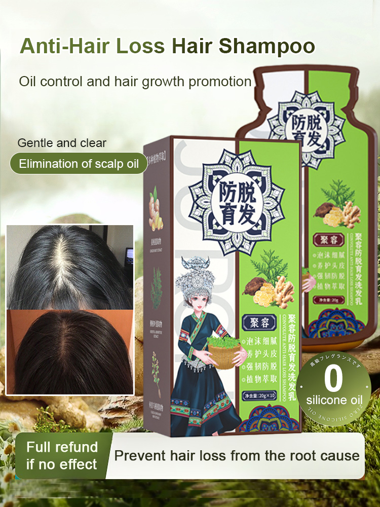 Hot Sale Ginger Plant Extract Anti-Hair Loss Hair Shampoo