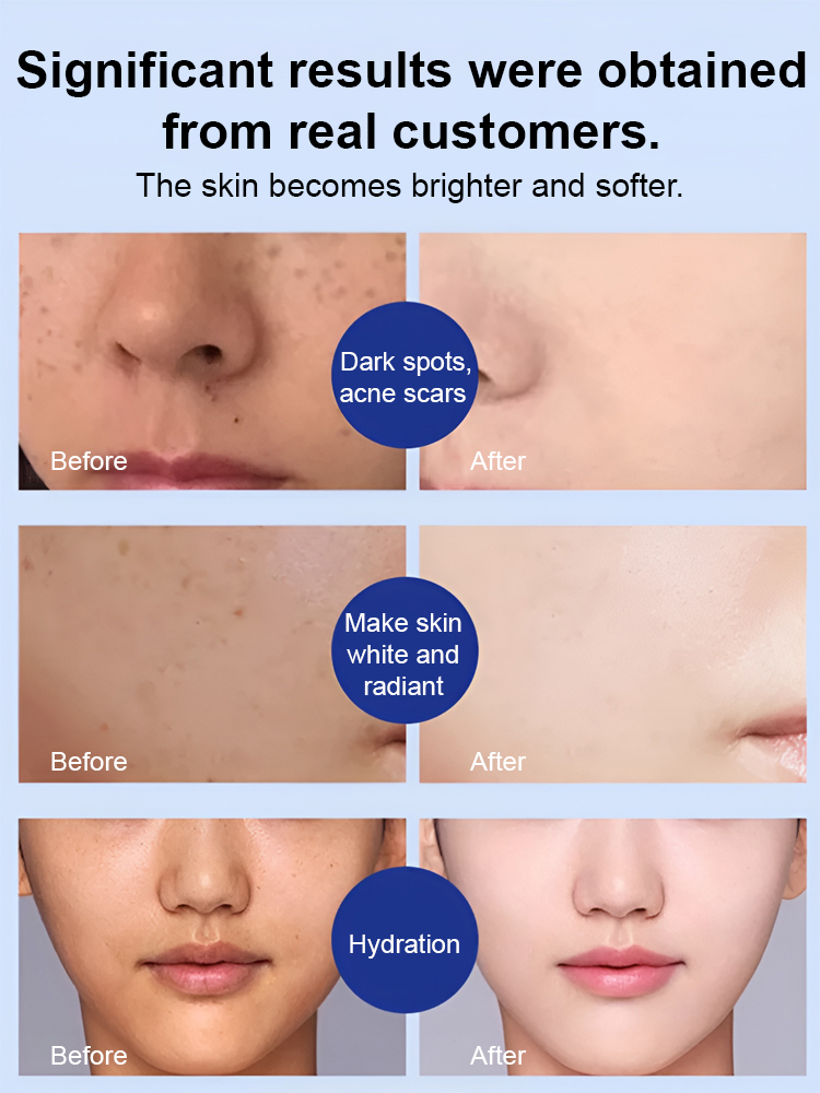 Fade Stain Whitening Cream