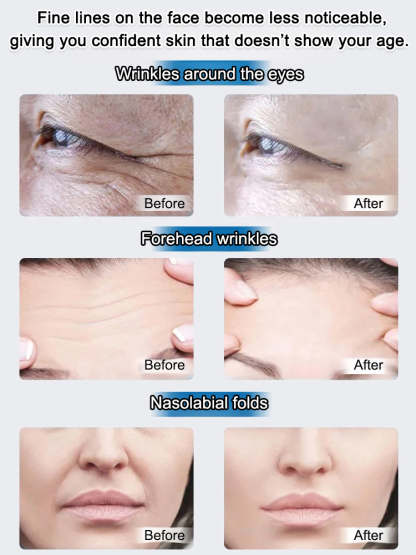 Rejuvenating Anti-Wrinkle Essence
