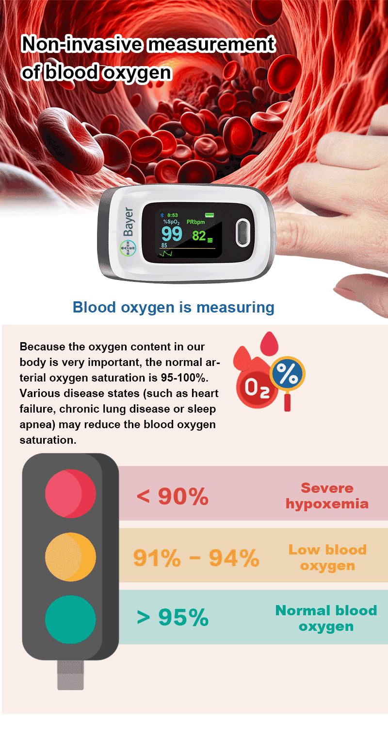 1741702304845576.gif 测血氧.gif