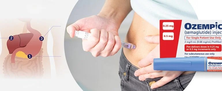 what-is-ozempic-used-for-and-how-does-it-work-770x315-1.jpg