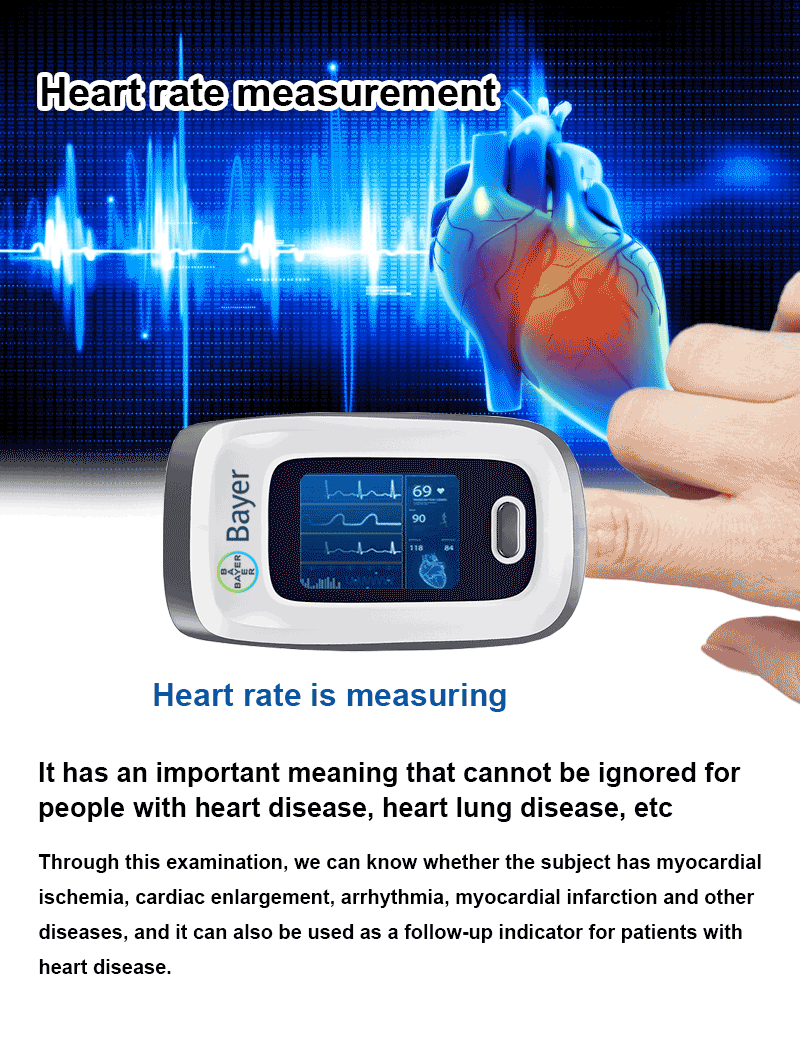 1741702454598808.gif 测心率.gif