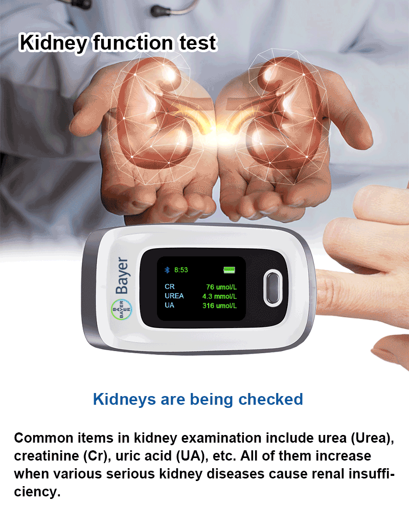 肾功能检查.gif