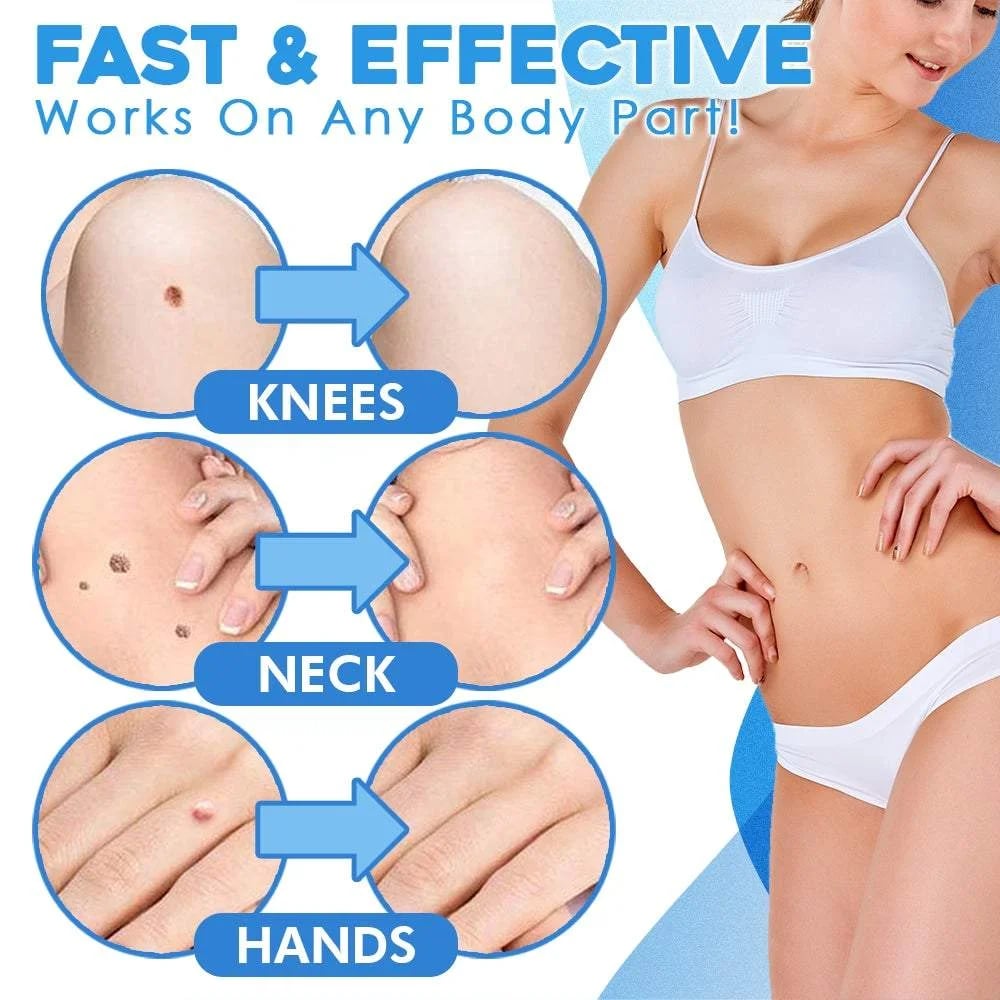 💡Samsend Black Friday Deals 49% OFF - Auto Tag Rapid Removal Kit