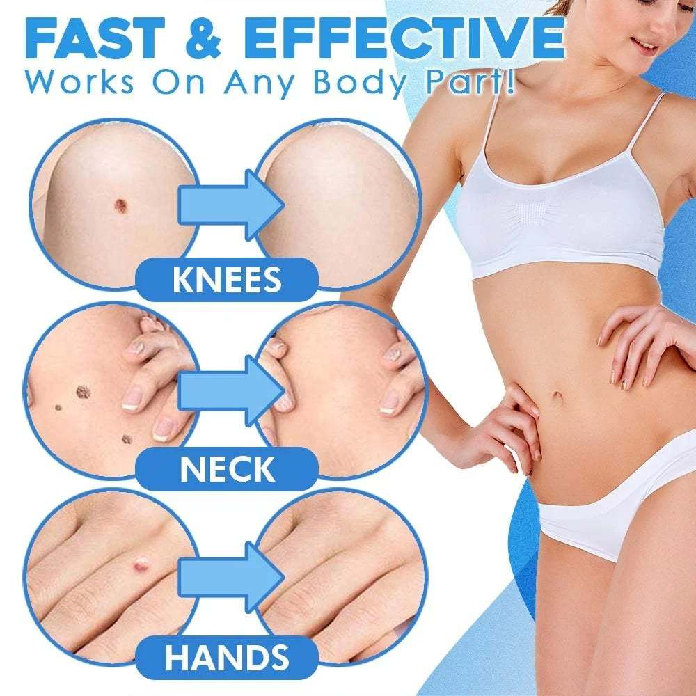 💡Samsend Black Friday Deals 49% OFF - Auto Tag Rapid Removal Kit