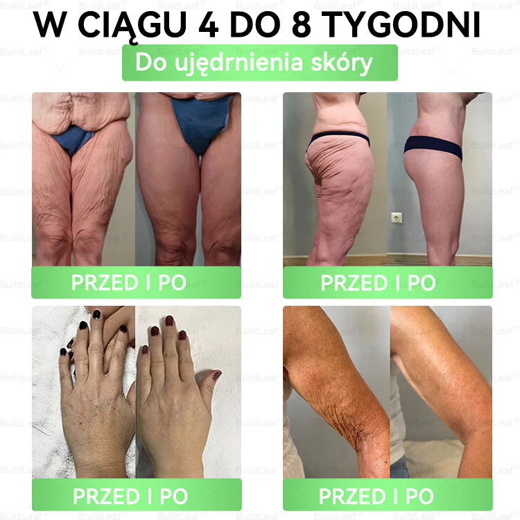 ♻️𝖮𝖿𝗂𝖼𝗃𝗮𝗅𝗇𝗒 𝘀𝗸𝗹𝗲𝗽 | 👩‍⚕️𝙈𝙀𝙏𝘼𝘽𝙄𝙊𝙉® 𝗚𝗟𝗣-𝟭 𝟖-w-𝟭 Smukły i zdrowy roztwór doustny (𝑟𝑎𝑧 𝑑𝑧𝑖𝑒𝑛𝑛𝑖𝑒, 𝑟𝑒𝑧𝑢𝑙𝑡𝑎𝑡𝑦 𝑤 7 𝑑𝑛𝑖), Wspiera odchudzanie, serce, cukrzycę, sen, jelita, stawy, a także ujędrnia skórę i dodaje