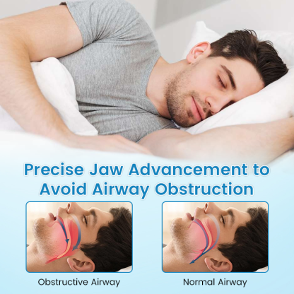 ✨QIAWI ™ Anti-Snoring & Anti-Grinding Teeth Protector