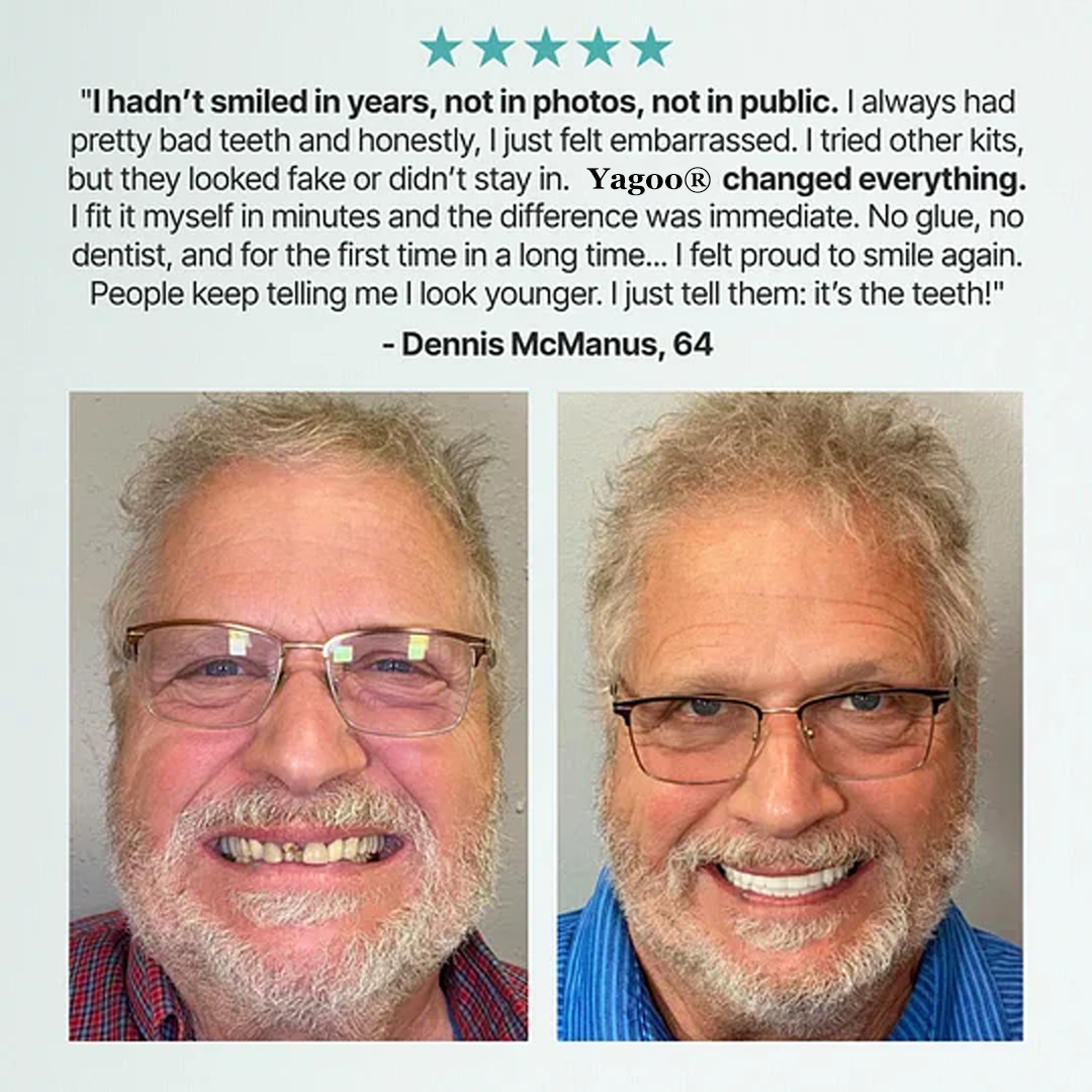 🦷Ends Today: 70% OFF! Yagoo®™ Custom-Fit Full Functional DenturesMake you more confident