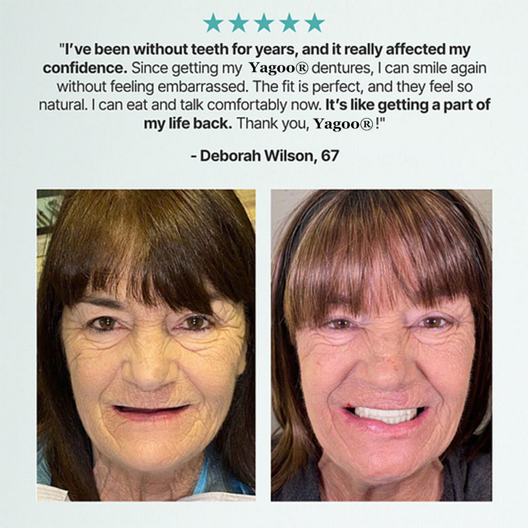 🦷Ends Today: 70% OFF! Yagoo®™ Custom-Fit Full Functional DenturesMake you more confident