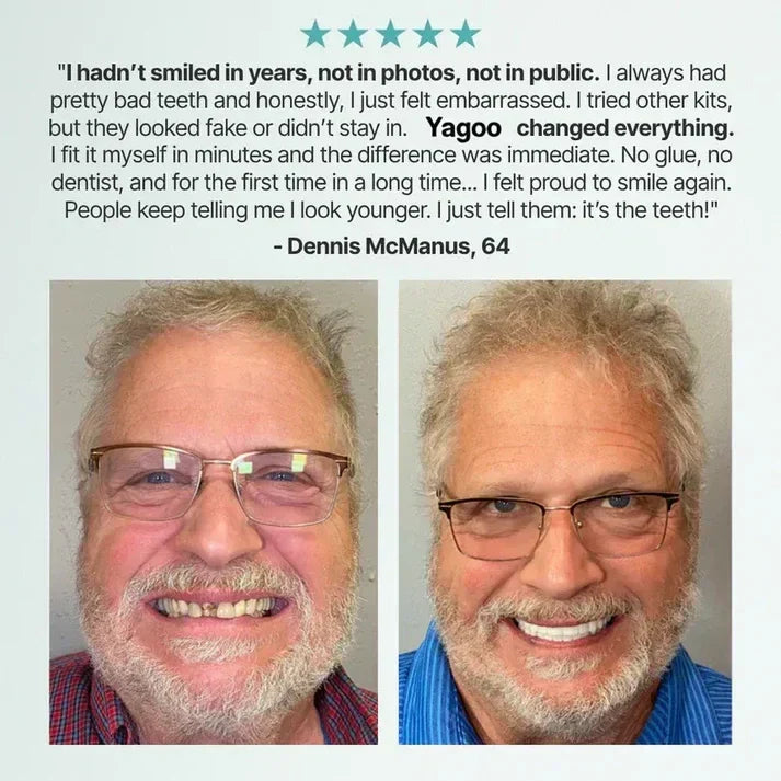 🦷 Yagoo™ Medical Full Dentures | Secure fit and no slippage, recreating the chewing experience of natural teeth!