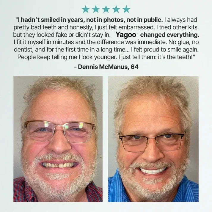 🦷 Yagoo™ Medical Full Dentures | Secure fit and no slippage, recreating the chewing experience of natural teeth!