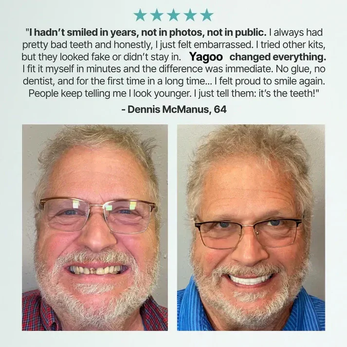 🌎Ends Today: 70% OFF! ⏰Yagoo™ Medical Full Denture with Strong Suctiond🦷Obtain American Dental Association (ADA) Certification