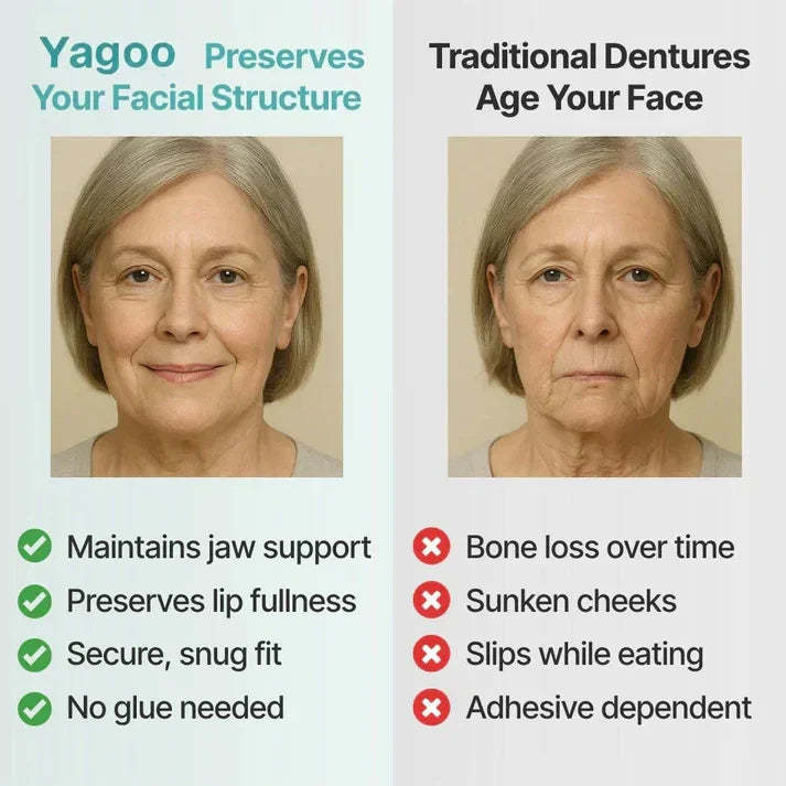 🦷 Yagoo™ Medical Full Dentures | Secure fit and no slippage, recreating the chewing experience of natural teeth!