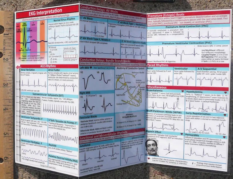 🎁TikTok Last Day Sale -70% OFF🔥EKG Pocket Guide