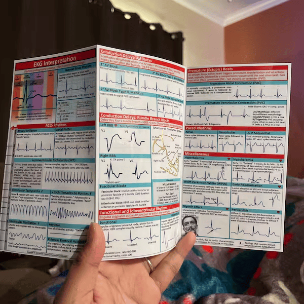 🎁TikTok Last Day Sale -70% OFF🔥EKG Pocket Guide