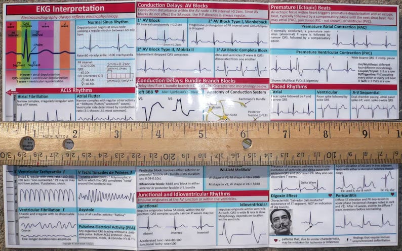 🎁TikTok Last Day Sale -70% OFF🔥EKG Pocket Guide