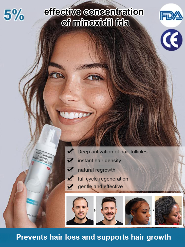 5% optimally concentrated minoxidil foam, see results in just one week, get your beautiful hair back! 🌟💁‍♂️💁‍♀️