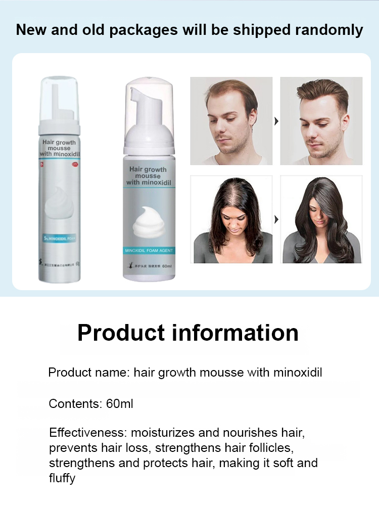 5% optimally concentrated minoxidil foam, see results in just one week, get your beautiful hair back! 🌟💁‍♂️💁‍♀️