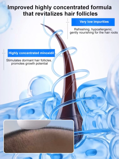 5% optimally concentrated minoxidil foam, see results in just one week, get your beautiful hair back! 🌟💁‍♂️💁‍♀️