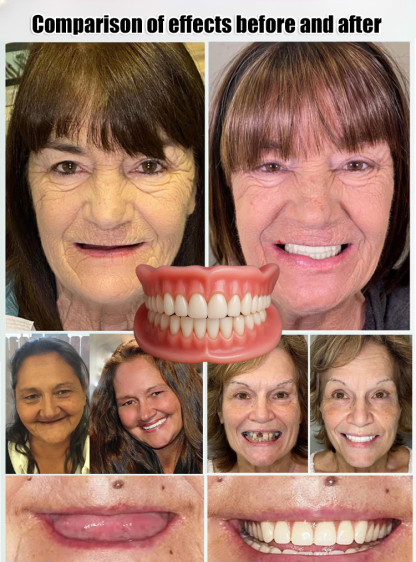 ⚡️ Snap in instantly! No glue needed—fits every smile: full, partial, or no teeth