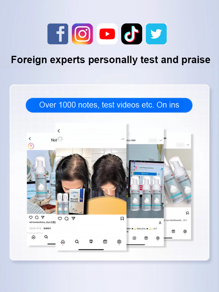 5% optimally concentrated minoxidil foam, see results in just one week, get your beautiful hair back! 🌟💁‍♂️💁‍♀️