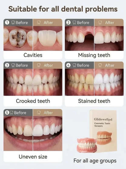 🦷[Epic Upgrade] Premium Full Cover Dentures🦷