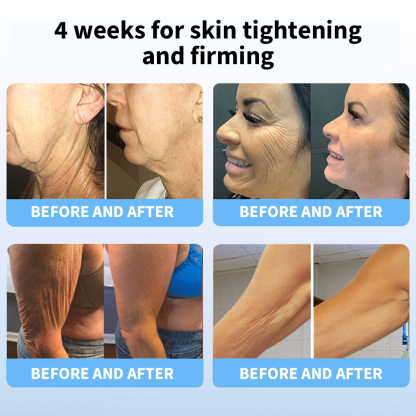 ✨🩵𝐋𝐚𝐬𝐭 𝐃𝐚𝐲 𝐃𝐢𝐬𝐜𝐨𝐮𝐧𝐭: 87% 𝐎𝐅𝐅🌸LOVILDS® 𝐀𝐝𝐯𝐚𝐧𝐜𝐞𝐝 𝐅𝐢𝐫𝐦𝐢𝐧𝐠 & 𝐖𝐫𝐢𝐧𝐤𝐥𝐞-𝐑𝐞𝐝𝐮𝐜𝐢𝐧𝐠 𝐂𝐫𝐞𝐚𝐦: Restore Skin Elasticity⭐-PLAWLTD