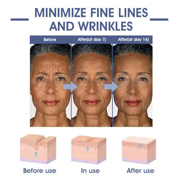 ✨🩵𝐋𝐚𝐬𝐭 𝐃𝐚𝐲 𝐃𝐢𝐬𝐜𝐨𝐮𝐧𝐭: 87% 𝐎𝐅𝐅🌸LOVILDS® 𝐀𝐝𝐯𝐚𝐧𝐜𝐞𝐝 𝐅𝐢𝐫𝐦𝐢𝐧𝐠 & 𝐖𝐫𝐢𝐧𝐤𝐥𝐞-𝐑𝐞𝐝𝐮𝐜𝐢𝐧𝐠 𝐂𝐫𝐞𝐚𝐦: Restore Skin Elasticity⭐-PLAWLTD