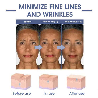 ✨🩵𝐋𝐚𝐬𝐭 𝐃𝐚𝐲 𝐃𝐢𝐬𝐜𝐨𝐮𝐧𝐭: 87% 𝐎𝐅𝐅🌸LOVILDS® 𝐀𝐝𝐯𝐚𝐧𝐜𝐞𝐝 𝐅𝐢𝐫𝐦𝐢𝐧𝐠 & 𝐖𝐫𝐢𝐧𝐤𝐥𝐞-𝐑𝐞𝐝𝐮𝐜𝐢𝐧𝐠 𝐂𝐫𝐞𝐚𝐦: Restore Skin Elasticity⭐-PLAWLTD