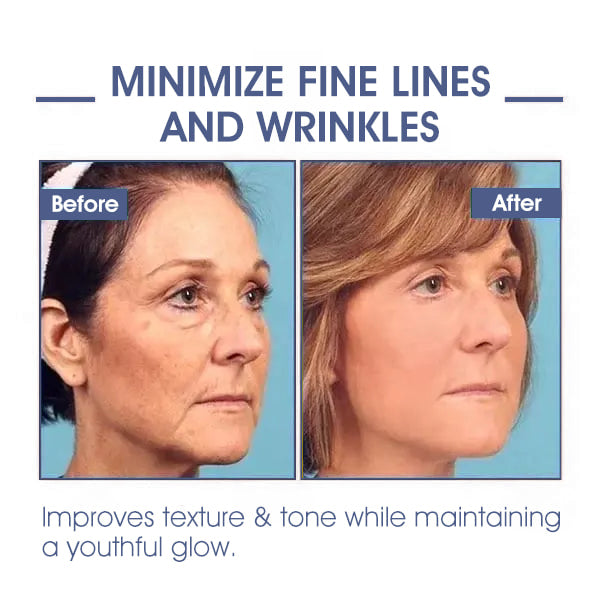 ✨🩵𝐋𝐚𝐬𝐭 𝐃𝐚𝐲 𝐃𝐢𝐬𝐜𝐨𝐮𝐧𝐭: 87% 𝐎𝐅𝐅🌸LOVILDS® 𝐀𝐝𝐯𝐚𝐧𝐜𝐞𝐝 𝐅𝐢𝐫𝐦𝐢𝐧𝐠 & 𝐖𝐫𝐢𝐧𝐤𝐥𝐞-𝐑𝐞𝐝𝐮𝐜𝐢𝐧𝐠 𝐂𝐫𝐞𝐚𝐦: Restore Skin Elasticity⭐-PLAWLTD