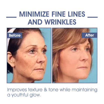 ✨🩵𝐋𝐚𝐬𝐭 𝐃𝐚𝐲 𝐃𝐢𝐬𝐜𝐨𝐮𝐧𝐭: 87% 𝐎𝐅𝐅🌸LOVILDS® 𝐀𝐝𝐯𝐚𝐧𝐜𝐞𝐝 𝐅𝐢𝐫𝐦𝐢𝐧𝐠 & 𝐖𝐫𝐢𝐧𝐤𝐥𝐞-𝐑𝐞𝐝𝐮𝐜𝐢𝐧𝐠 𝐂𝐫𝐞𝐚𝐦: Restore Skin Elasticity⭐-PLAWLTD