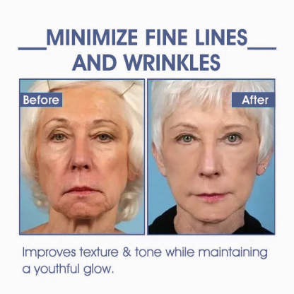 ✨🩵𝐋𝐚𝐬𝐭 𝐃𝐚𝐲 𝐃𝐢𝐬𝐜𝐨𝐮𝐧𝐭: 87% 𝐎𝐅𝐅🌸LOVILDS® 𝐀𝐝𝐯𝐚𝐧𝐜𝐞𝐝 𝐅𝐢𝐫𝐦𝐢𝐧𝐠 & 𝐖𝐫𝐢𝐧𝐤𝐥𝐞-𝐑𝐞𝐝𝐮𝐜𝐢𝐧𝐠 𝐂𝐫𝐞𝐚𝐦: Restore Skin Elasticity⭐-PLAWLTD