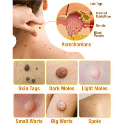 🐝TagRecede Bee Venom Treatment Spray