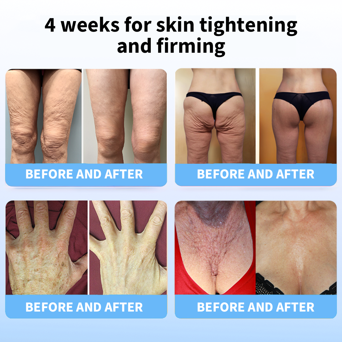 ✨🩵𝐋𝐚𝐬𝐭 𝐃𝐚𝐲 𝐃𝐢𝐬𝐜𝐨𝐮𝐧𝐭: 87% 𝐎𝐅𝐅🌸LOVILDS® 𝐀𝐝𝐯𝐚𝐧𝐜𝐞𝐝 𝐅𝐢𝐫𝐦𝐢𝐧𝐠 & 𝐖𝐫𝐢𝐧𝐤𝐥𝐞-𝐑𝐞𝐝𝐮𝐜𝐢𝐧𝐠 𝐂𝐫𝐞𝐚𝐦: Restore Skin Elasticity⭐-PLAWLTD