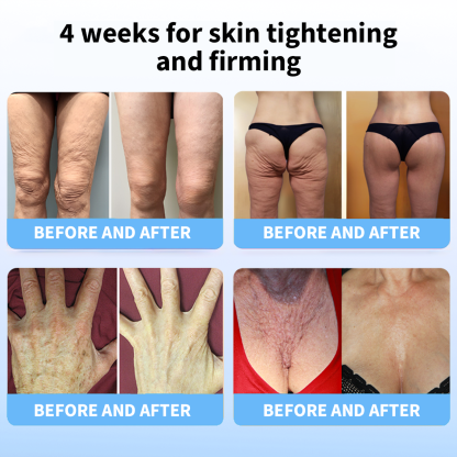 ✨🩵𝐋𝐚𝐬𝐭 𝐃𝐚𝐲 𝐃𝐢𝐬𝐜𝐨𝐮𝐧𝐭: 87% 𝐎𝐅𝐅🌸LOVILDS® 𝐀𝐝𝐯𝐚𝐧𝐜𝐞𝐝 𝐅𝐢𝐫𝐦𝐢𝐧𝐠 & 𝐖𝐫𝐢𝐧𝐤𝐥𝐞-𝐑𝐞𝐝𝐮𝐜𝐢𝐧𝐠 𝐂𝐫𝐞𝐚𝐦: Restore Skin Elasticity⭐-PLAWLTD