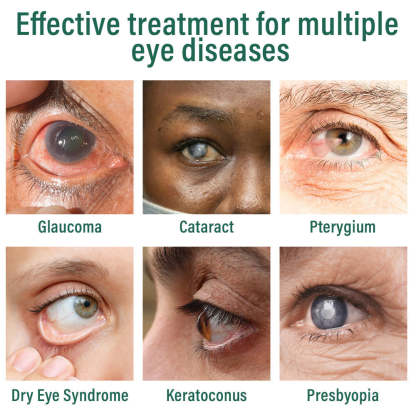 PLAWLTD™ Nano Eye Repair Solution-PLAWLTD