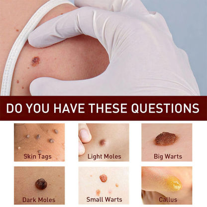 ✨Tags & Moles Remover-PLAWLTD