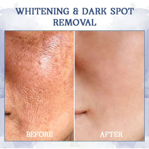✨🩵𝐋𝐚𝐬𝐭 𝐃𝐚𝐲 𝐃𝐢𝐬𝐜𝐨𝐮𝐧𝐭: 87% 𝐎𝐅𝐅🌸LOVILDS® 𝐀𝐝𝐯𝐚𝐧𝐜𝐞𝐝 𝐅𝐢𝐫𝐦𝐢𝐧𝐠 & 𝐖𝐫𝐢𝐧𝐤𝐥𝐞-𝐑𝐞𝐝𝐮𝐜𝐢𝐧𝐠 𝐂𝐫𝐞𝐚𝐦: Restore Skin Elasticity⭐-PLAWLTD