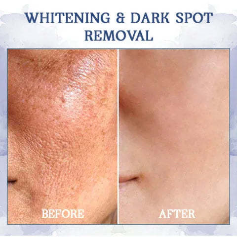✨🩵𝐋𝐚𝐬𝐭 𝐃𝐚𝐲 𝐃𝐢𝐬𝐜𝐨𝐮𝐧𝐭: 87% 𝐎𝐅𝐅🌸LOVILDS® 𝐀𝐝𝐯𝐚𝐧𝐜𝐞𝐝 𝐅𝐢𝐫𝐦𝐢𝐧𝐠 & 𝐖𝐫𝐢𝐧𝐤𝐥𝐞-𝐑𝐞𝐝𝐮𝐜𝐢𝐧𝐠 𝐂𝐫𝐞𝐚𝐦: Restore Skin Elasticity⭐-PLAWLTD