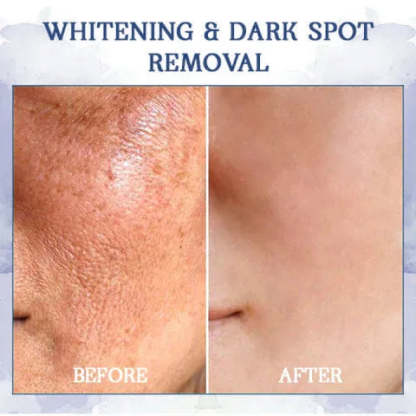 ✨🩵𝐋𝐚𝐬𝐭 𝐃𝐚𝐲 𝐃𝐢𝐬𝐜𝐨𝐮𝐧𝐭: 87% 𝐎𝐅𝐅🌸LOVILDS® 𝐀𝐝𝐯𝐚𝐧𝐜𝐞𝐝 𝐅𝐢𝐫𝐦𝐢𝐧𝐠 & 𝐖𝐫𝐢𝐧𝐤𝐥𝐞-𝐑𝐞𝐝𝐮𝐜𝐢𝐧𝐠 𝐂𝐫𝐞𝐚𝐦: Restore Skin Elasticity⭐-PLAWLTD